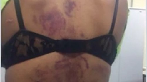 [Mulher é torturada com rolo de macarrão; Companheiro é preso]