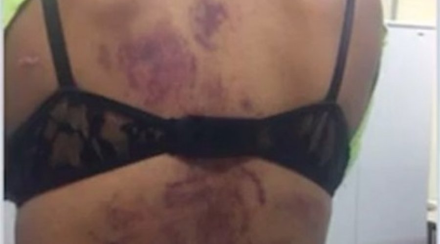 [Mulher é torturada com rolo de macarrão; Companheiro é preso]