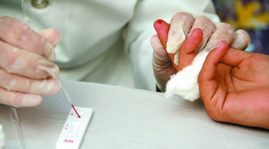 [Homens entre 20 e 34 representam maioria dos diagnósticos de Aids na Bahia]