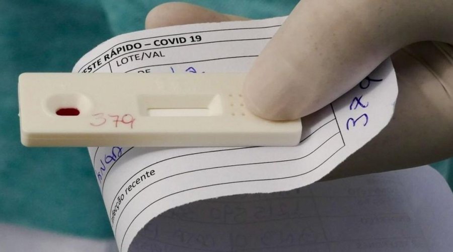 [Ministério da Saúde obriga laboratórios a notificar em até 24h resultados de testes da Covid-19]