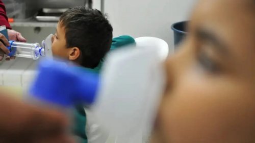 [Governo Federal destina R$ 100 milhões ao SUS para tratar crianças com Síndrome Respiratória A...]
