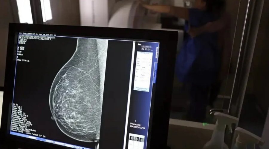 [Câncer de mama é a principal causa de morte por câncer entre mulheres na Bahia]