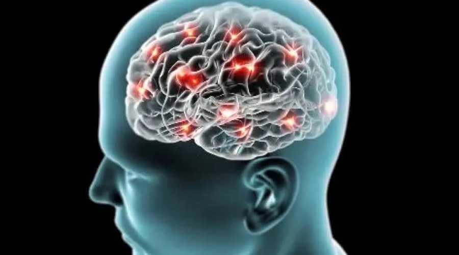 [Morte encefálica: entenda o que é e quais etapas são necessárias para confirmar o diagnóstico]